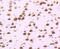 DEAD-Box Helicase 5 antibody, NBP2-67034, Novus Biologicals, Immunohistochemistry paraffin image 