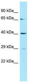 Uroporphyrinogen decarboxylase antibody, TA346182, Origene, Western Blot image 