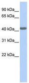 CD192 antibody, TA344354, Origene, Western Blot image 
