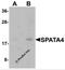 Spermatogenesis-associated protein 4 antibody, 6553, ProSci, Western Blot image 