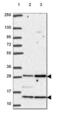 Chromosome 18 Open Reading Frame 21 antibody, NBP2-49449, Novus Biologicals, Western Blot image 