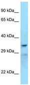 Sex Hormone Binding Globulin antibody, TA343266, Origene, Western Blot image 