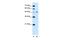 Carbohydrate sulfotransferase 1 antibody, PA5-42740, Invitrogen Antibodies, Western Blot image 