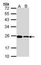 Ribosomal Protein L17 antibody, GTX111934, GeneTex, Western Blot image 