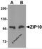 Zinc transporter ZIP10 antibody, 6099, ProSci Inc, Western Blot image 