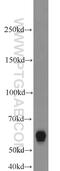 ATP-dependent DNA helicase Q5 antibody, 12468-2-AP, Proteintech Group, Western Blot image 