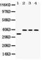 Protein Phosphatase 1 Regulatory Inhibitor Subunit 1B antibody, PA5-79859, Invitrogen Antibodies, Western Blot image 