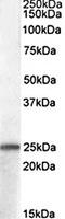 PACAP27 antibody, orb20331, Biorbyt, Western Blot image 