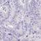 Potassium Calcium-Activated Channel Subfamily N Member 4 antibody, HPA059622, Atlas Antibodies, Immunohistochemistry frozen image 