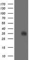 Serine Dehydratase Like antibody, M07606, Boster Biological Technology, Western Blot image 