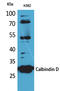 Calbindin 1 antibody, STJ96574, St John