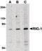 DExD/H-Box Helicase 58 antibody, PA5-20276, Invitrogen Antibodies, Western Blot image 