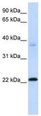 Chromosome 11 Open Reading Frame 74 antibody, TA340304, Origene, Western Blot image 