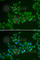 Carnitine O-Acetyltransferase antibody, A6365, ABclonal Technology, Immunofluorescence image 