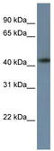 Zinc Finger Protein 669 antibody, TA345403, Origene, Western Blot image 