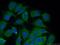 14-3-3 sigma antibody, 66251-1-Ig, Proteintech Group, Immunofluorescence image 