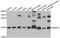 Small Nuclear Ribonucleoprotein D2 Polypeptide antibody, A13356, ABclonal Technology, Western Blot image 
