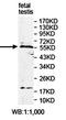 Glutamyl-TRNA Synthetase 2, Mitochondrial antibody, orb78332, Biorbyt, Western Blot image 