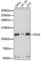 Phospholipase D1 antibody, A15081, ABclonal Technology, Western Blot image 
