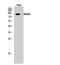 MDM2 Proto-Oncogene antibody, STJ94057, St John