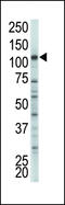 Hexokinase-2 antibody, LS-C101273, Lifespan Biosciences, Western Blot image 