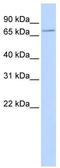 Sodium-iodide symporter antibody, TA334165, Origene, Western Blot image 