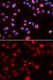 N-Methylpurine DNA Glycosylase antibody, GTX54286, GeneTex, Immunofluorescence image 