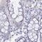 Semenogelin 2 antibody, PA5-60142, Invitrogen Antibodies, Immunohistochemistry frozen image 