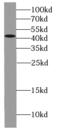 Estrogen Receptor 2 antibody, FNab02869, FineTest, Western Blot image 