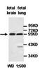 Protein archease antibody, orb77666, Biorbyt, Western Blot image 
