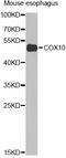 Cytochrome C Oxidase Assembly Factor Heme A:Farnesyltransferase COX10 antibody, STJ29685, St John