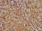Lysosomal-associated transmembrane protein 4B antibody, LS-C674302, Lifespan Biosciences, Immunohistochemistry paraffin image 