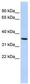Progestin And AdipoQ Receptor Family Member 6 antibody, TA338687, Origene, Western Blot image 