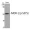 Opioid Receptor Mu 1 antibody, P00737, Boster Biological Technology, Western Blot image 
