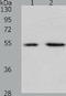 Proteasome 26S Subunit, Non-ATPase 5 antibody, TA324262, Origene, Western Blot image 