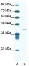 Hypoxia-inducible factor 1-alpha inhibitor antibody, TA331877, Origene, Western Blot image 