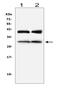 Insulin Like Growth Factor Binding Protein 1 antibody, A00922-1, Boster Biological Technology, Western Blot image 