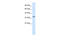 Hematopoietically-expressed homeobox protein HHEX antibody, 27-347, ProSci, Western Blot image 