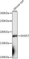 DExH-Box Helicase 57 antibody, 16-668, ProSci, Western Blot image 