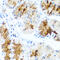 Laminin Subunit Beta 3 antibody, 23-418, ProSci, Immunohistochemistry paraffin image 