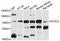 5'-Nucleotidase, Cytosolic II antibody, abx126279, Abbexa, Western Blot image 