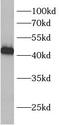 Branched Chain Keto Acid Dehydrogenase E1 Subunit Beta antibody, FNab00834, FineTest, Western Blot image 