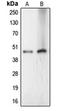 LAG1 longevity assurance homolog 4 antibody, orb215288, Biorbyt, Western Blot image 