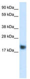 Muscle LIM protein antibody, TA335770, Origene, Western Blot image 