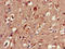 Circadian locomoter output cycles protein kaput antibody, LS-C677566, Lifespan Biosciences, Immunohistochemistry paraffin image 
