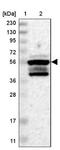 Zinc Finger Protein 200 antibody, NBP1-87460, Novus Biologicals, Western Blot image 