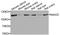 N(Alpha)-Acetyltransferase 25, NatB Auxiliary Subunit antibody, A8516, ABclonal Technology, Western Blot image 