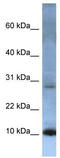 ATP synthase lipid-binding protein, mitochondrial antibody, TA345698, Origene, Western Blot image 