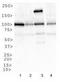 Insulin Like Growth Factor 1 Receptor antibody, TA309698, Origene, Western Blot image 