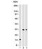 Chymotrypsin Like Elastase 3B antibody, 33-922, ProSci, Western Blot image 